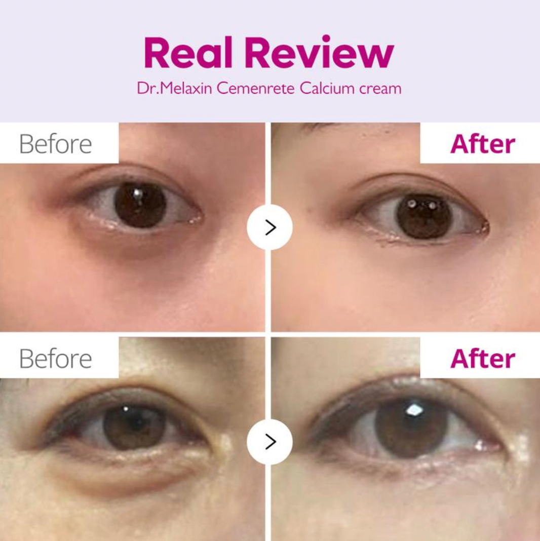 Cemenrete Calcium Intense Firming Cream